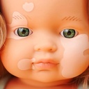 Caucasian Girl with Vitiligo 15" My Friends & Me Baby Doll.2