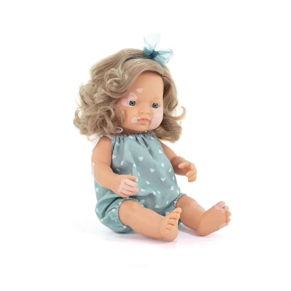 Caucasian Girl with Vitiligo 15" My Friends & Me Baby Doll